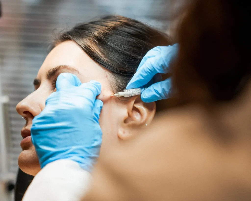 Dermal filler injection at The Aesthetics Lounge and Spa Clinton Township