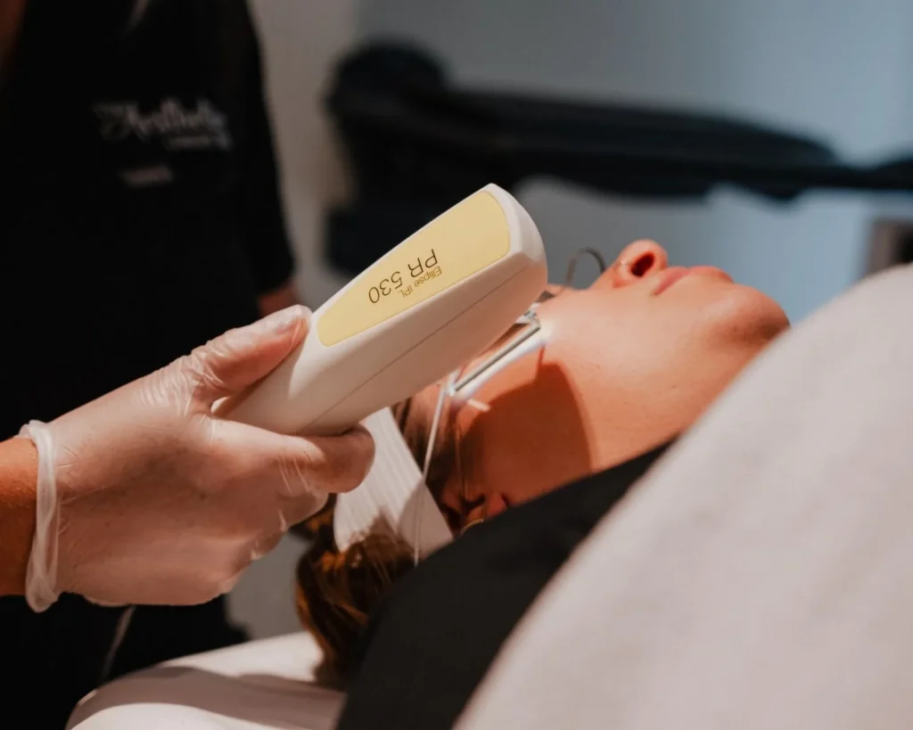 DPL laser skin treatment at The Aesthetics Lounge and Spa Clinton Township