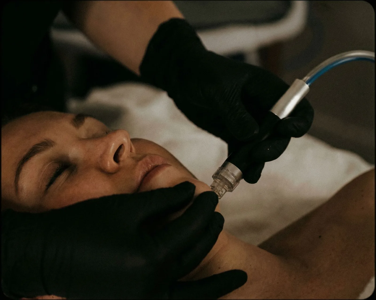 Hydradermabrasion facial at The Aesthetics Lounge and Spa Clinton Township