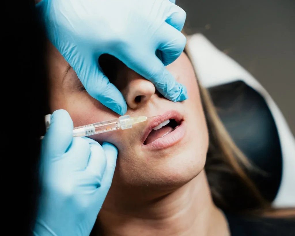 Lip filler enhancement at The Aesthetics Lounge and Spa Clinton Township